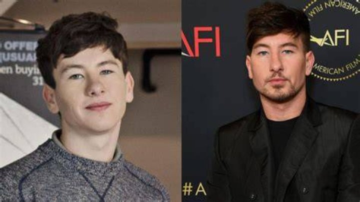 Barry Keoghan’s Plastic Surgery
