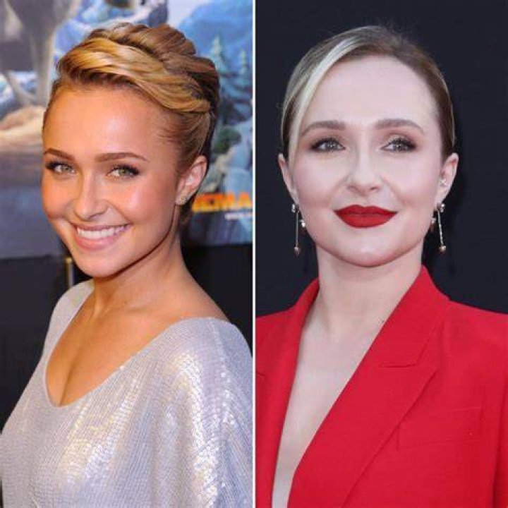 Hayden Panettiere Breast Implants Plastic Surgery Before and After