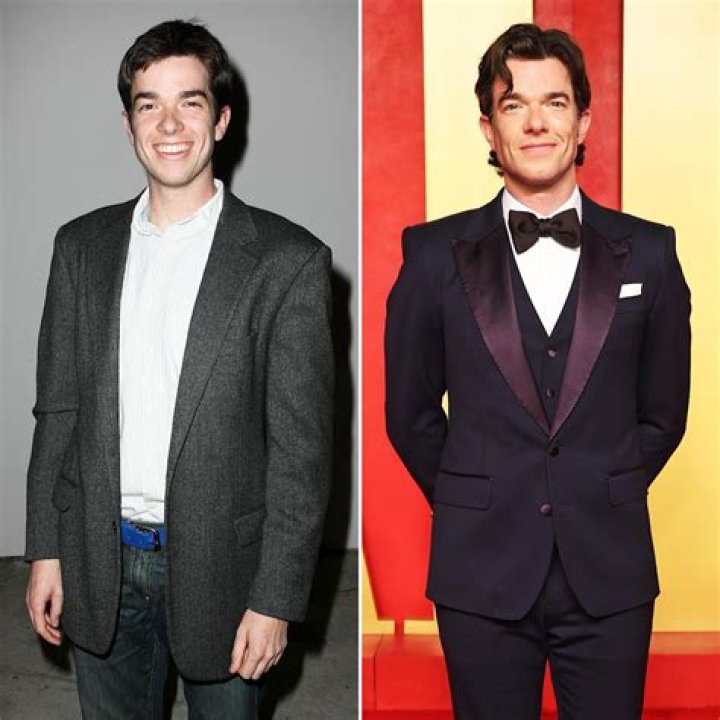 John Mulaney Plastic Surgery